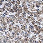 AMACR Antibody in Immunohistochemistry (Paraffin) (IHC (P))