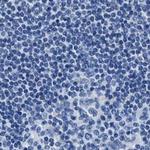 AMACR Antibody in Immunohistochemistry (Paraffin) (IHC (P))