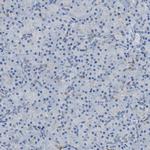 AMACR Antibody in Immunohistochemistry (Paraffin) (IHC (P))