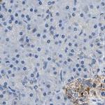 AMACR Antibody in Immunohistochemistry (Paraffin) (IHC (P))