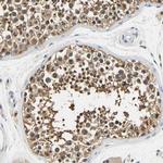 UCHL3 Antibody in Immunohistochemistry (Paraffin) (IHC (P))