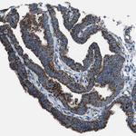 MDH2 Antibody in Immunohistochemistry (Paraffin) (IHC (P))