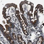 MDH2 Antibody in Immunohistochemistry (Paraffin) (IHC (P))