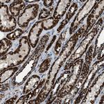 MDH2 Antibody in Immunohistochemistry (Paraffin) (IHC (P))