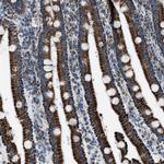 MDH2 Antibody in Immunohistochemistry (Paraffin) (IHC (P))