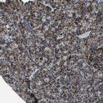 MDH2 Antibody in Immunohistochemistry (Paraffin) (IHC (P))