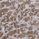 RBKS Antibody in Immunohistochemistry (Paraffin) (IHC (P))