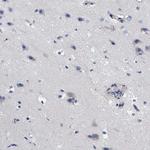 RBKS Antibody in Immunohistochemistry (Paraffin) (IHC (P))