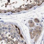 RBKS Antibody in Immunohistochemistry (Paraffin) (IHC (P))