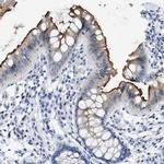 CEA Antibody in Immunohistochemistry (Paraffin) (IHC (P))