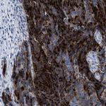 CEA Antibody in Immunohistochemistry (Paraffin) (IHC (P))