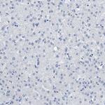 CEA Antibody in Immunohistochemistry (Paraffin) (IHC (P))