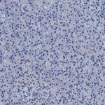 CEA Antibody in Immunohistochemistry (Paraffin) (IHC (P))