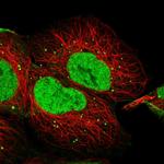 BCL7A Antibody in Immunocytochemistry (ICC/IF)