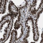 NuMA Antibody in Immunohistochemistry (Paraffin) (IHC (P))