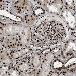 NuMA Antibody in Immunohistochemistry (Paraffin) (IHC (P))