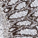 NuMA Antibody in Immunohistochemistry (Paraffin) (IHC (P))