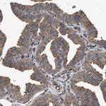 DUSP14 Antibody in Immunohistochemistry (Paraffin) (IHC (P))