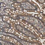 DUSP14 Antibody in Immunohistochemistry (Paraffin) (IHC (P))