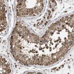 DUSP14 Antibody in Immunohistochemistry (Paraffin) (IHC (P))