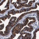 RUVBL1 Antibody in Immunohistochemistry (Paraffin) (IHC (P))