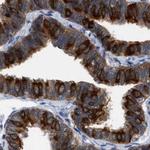 RUVBL1 Antibody in Immunohistochemistry (Paraffin) (IHC (P))