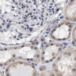 RUVBL1 Antibody in Immunohistochemistry (Paraffin) (IHC (P))