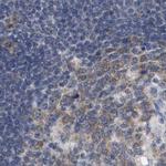 RUVBL1 Antibody in Immunohistochemistry (Paraffin) (IHC (P))