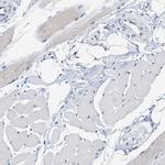 RUVBL1 Antibody in Immunohistochemistry (Paraffin) (IHC (P))