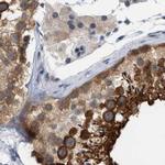 RUVBL1 Antibody in Immunohistochemistry (Paraffin) (IHC (P))