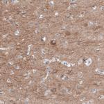 RyR2 Antibody in Immunohistochemistry (Paraffin) (IHC (P))