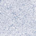 RyR2 Antibody in Immunohistochemistry (Paraffin) (IHC (P))