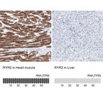 RyR2 Antibody