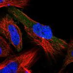 LIS1 Antibody in Immunocytochemistry (ICC/IF)