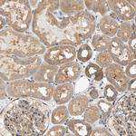 LIS1 Antibody in Immunohistochemistry (Paraffin) (IHC (P))