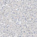 LIS1 Antibody in Immunohistochemistry (Paraffin) (IHC (P))