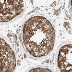 LIS1 Antibody in Immunohistochemistry (Paraffin) (IHC (P))