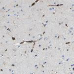 DUSP8 Antibody in Immunohistochemistry (Paraffin) (IHC (P))