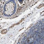 DUSP8 Antibody in Immunohistochemistry (Paraffin) (IHC (P))