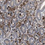 PLCG2 Antibody in Immunohistochemistry (Paraffin) (IHC (P))