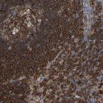 PLCG2 Antibody in Immunohistochemistry (Paraffin) (IHC (P))