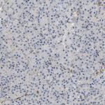 PLCG2 Antibody in Immunohistochemistry (Paraffin) (IHC (P))