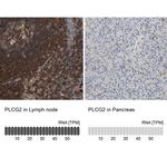 PLCG2 Antibody