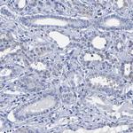 Carboxypeptidase A2 Antibody in Immunohistochemistry (Paraffin) (IHC (P))