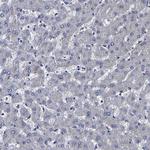 Carboxypeptidase A2 Antibody in Immunohistochemistry (Paraffin) (IHC (P))