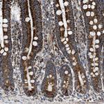 OGDH Antibody in Immunohistochemistry (Paraffin) (IHC (P))