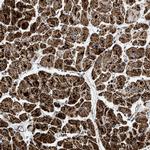 OGDH Antibody in Immunohistochemistry (Paraffin) (IHC (P))