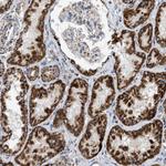 OGDH Antibody in Immunohistochemistry (Paraffin) (IHC (P))