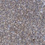 OGDH Antibody in Immunohistochemistry (Paraffin) (IHC (P))