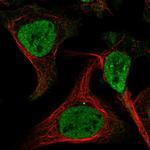 EXOSC3 Antibody in Immunocytochemistry (ICC/IF)